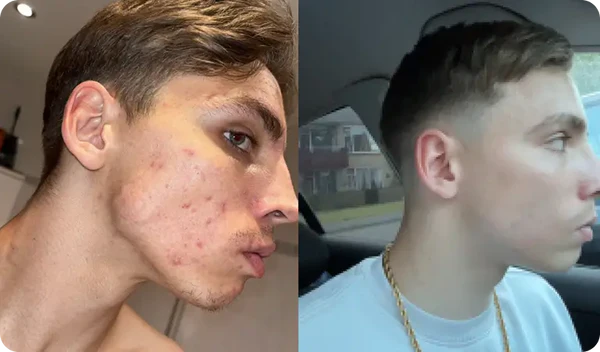 "The only thing that really worked"