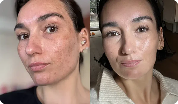 "My skin is calmer and smoother"