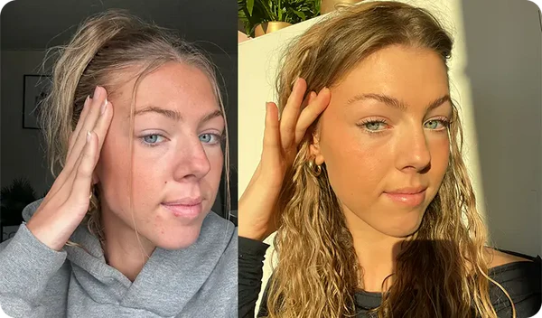 "I thought it was part of my skin"